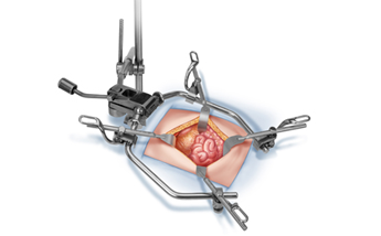 Omni-Tract Retractors System